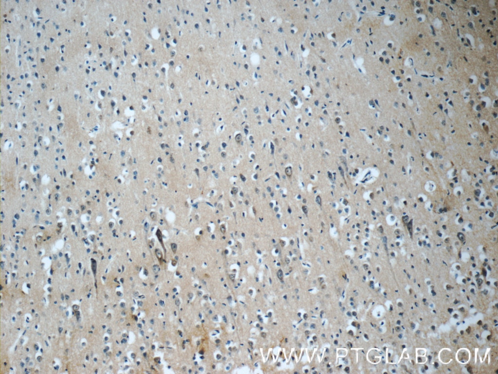 Immunohistochemistry (IHC) staining of human brain tissue using EB3 Polyclonal antibody (23974-1-AP)