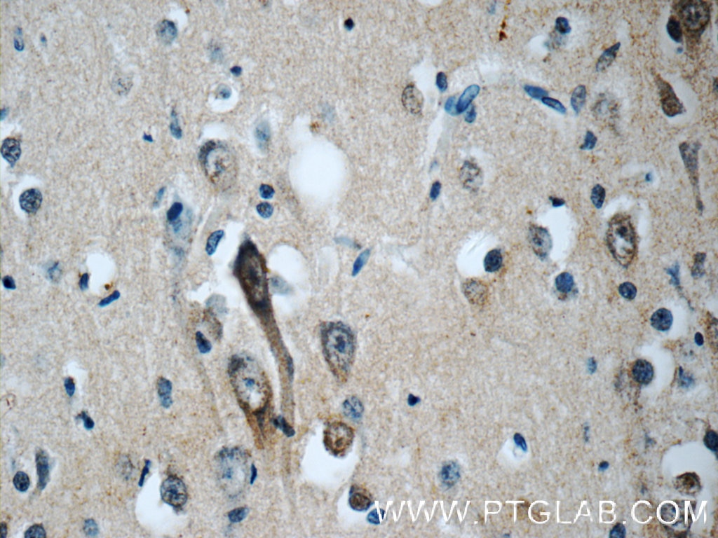 Immunohistochemistry (IHC) staining of human brain tissue using EB3 Polyclonal antibody (23974-1-AP)