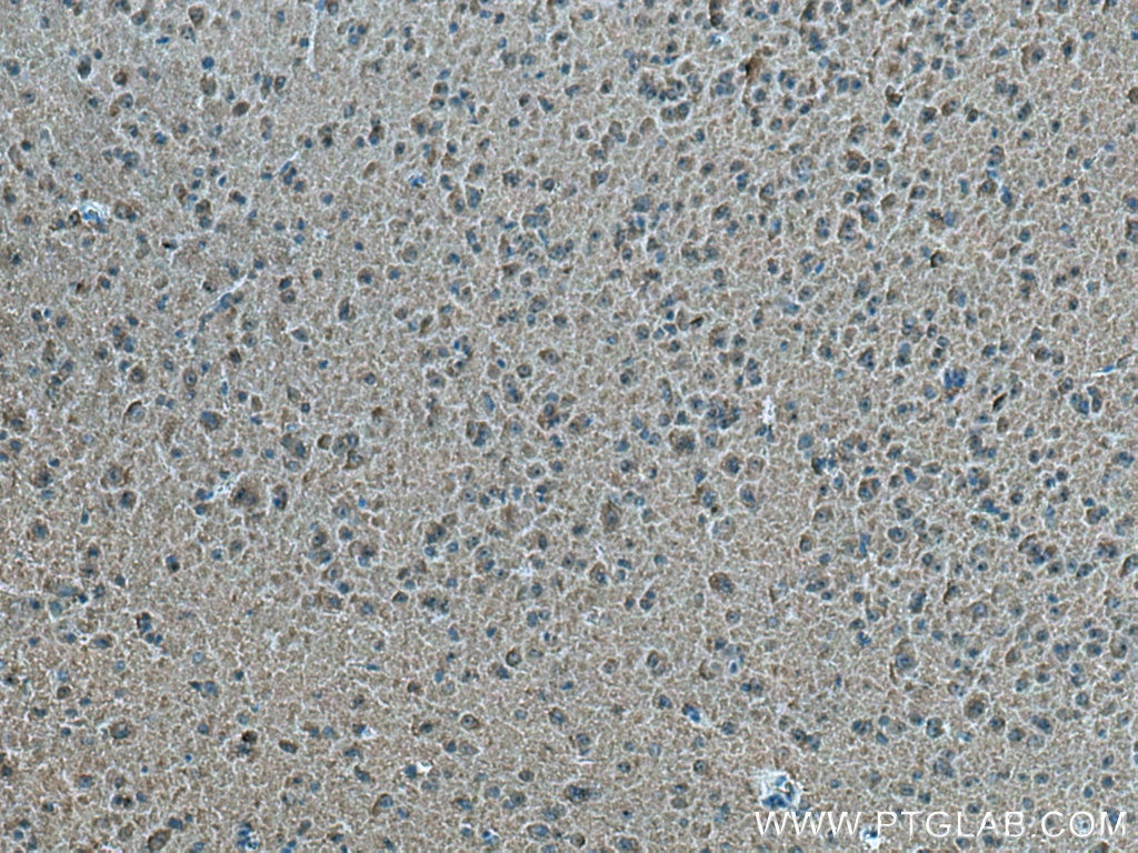 IHC staining of mouse brain using 23974-1-AP