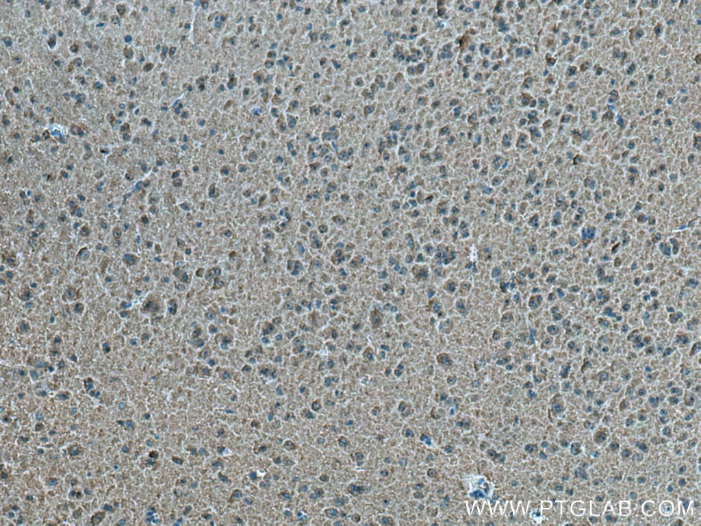 Immunohistochemistry (IHC) staining of mouse brain tissue using EB3 Polyclonal antibody (23974-1-AP)