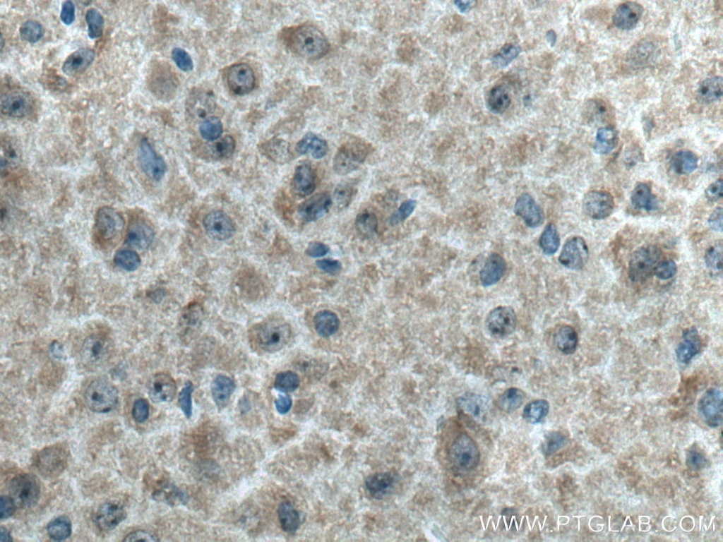 Immunohistochemical analysis of paraffin-embedded mouse brain tissue slide using 23974-1-AP (EB3 antibody) at dilution of 1:200 (under 40x lens). Heat mediated antigen retrieval with Tris-EDTA buffer (pH 9.0). Immunohistochemistry (IHC) staining of mouse brain tissue using EB3 Polyclonal antibody (23974-1-AP)