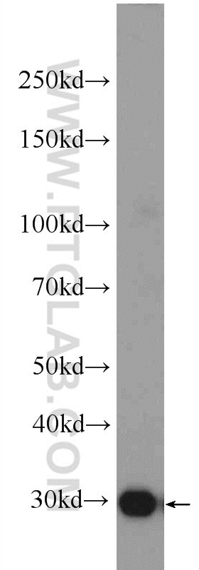 WB analysis of mouse brain using 23974-1-AP