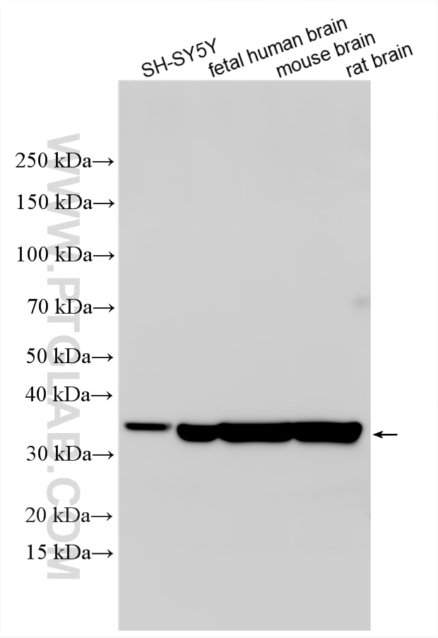 Various lysates were subjected to SDS PAGE followed by western blot with 23974-1-AP (EB3 antibody) at dilution of 1:4000 incubated at room temperature for 1.5 hours. Western Blot (WB) analysis of various lysates using EB3 Polyclonal antibody (23974-1-AP)