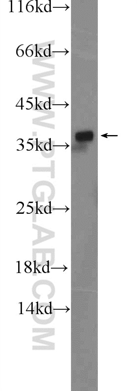 Western Blot (WB) analysis of mouse brain tissue using EB3 Polyclonal antibody (23974-1-AP)