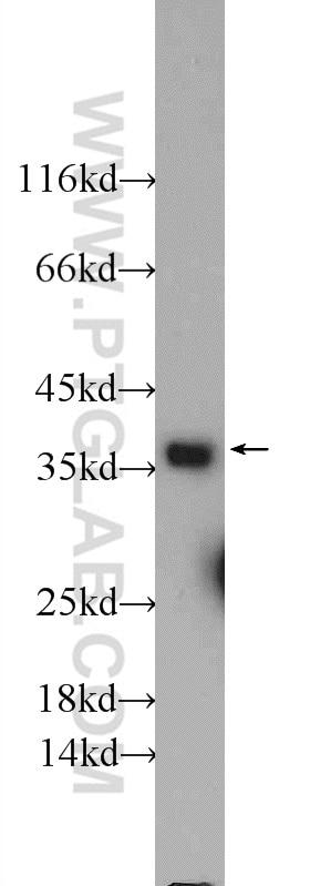 Western Blot (WB) analysis of mouse brain tissue using EB3 Polyclonal antibody (23974-1-AP)