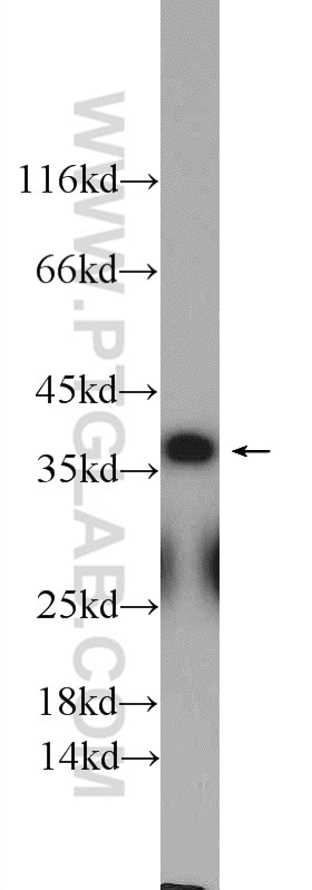 Western Blot (WB) analysis of rat brain tissue using EB3 Polyclonal antibody (23974-1-AP)