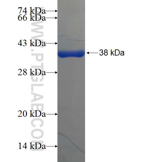 MAPRE3 fusion protein Ag21148 SDS-PAGE