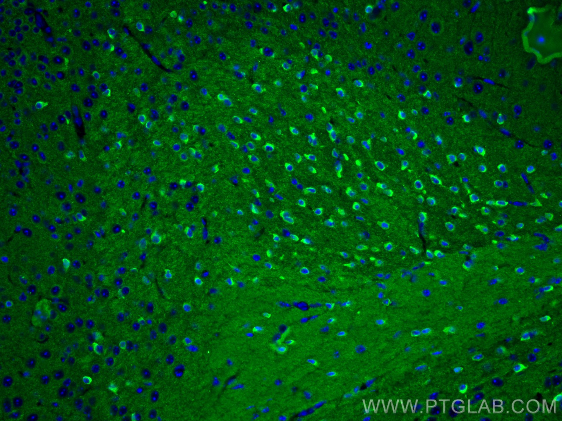 Immunofluorescence (IF) / fluorescent staining of mouse brain tissue using TAU Polyclonal antibody (10274-1-AP)