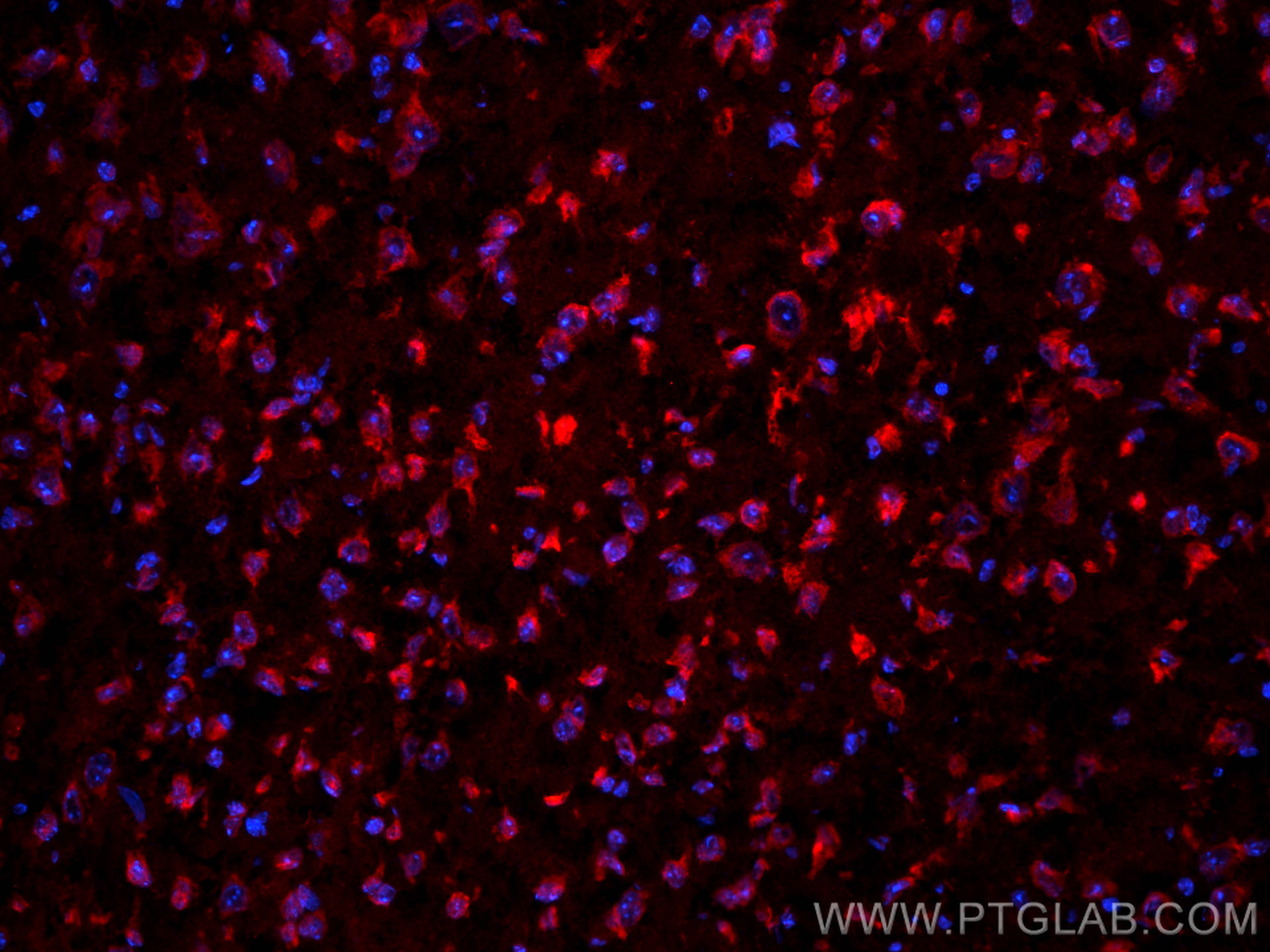 IF Staining of mouse brain using 10274-1-AP