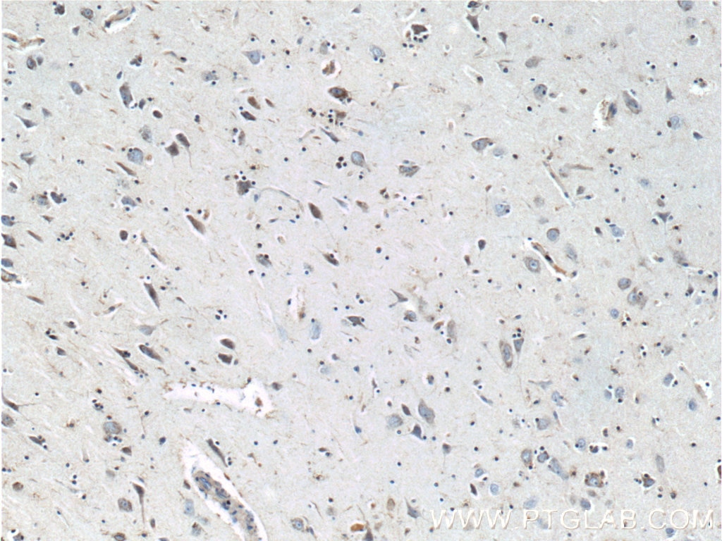 Immunohistochemistry (IHC) staining of human brain tissue using TAU Polyclonal antibody (10274-1-AP)