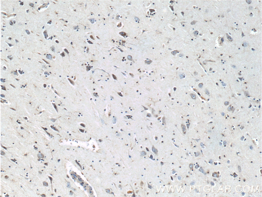 IHC staining of human brain using 10274-1-AP