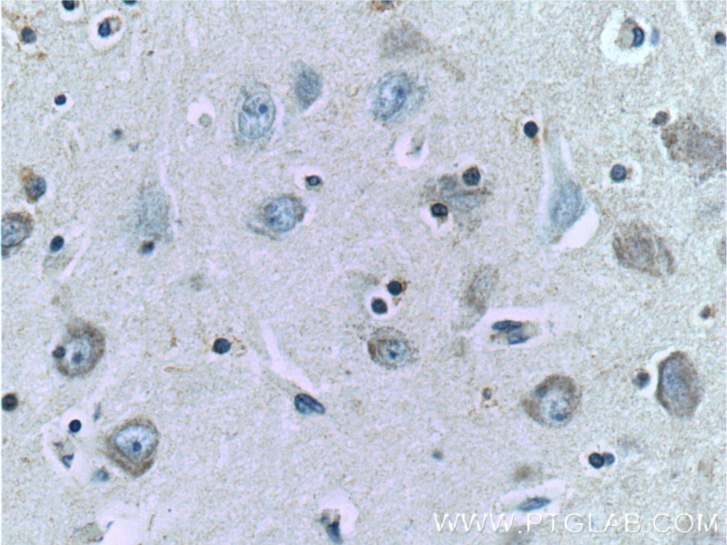 Immunohistochemistry (IHC) staining of human brain tissue using TAU Polyclonal antibody (10274-1-AP)
