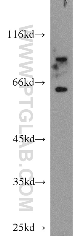 TAU Polyclonal antibody