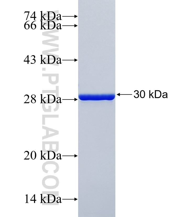 MAPT fusion protein Ag35380 SDS-PAGE MAPT fusion protein Ag35380 SDS-PAGE