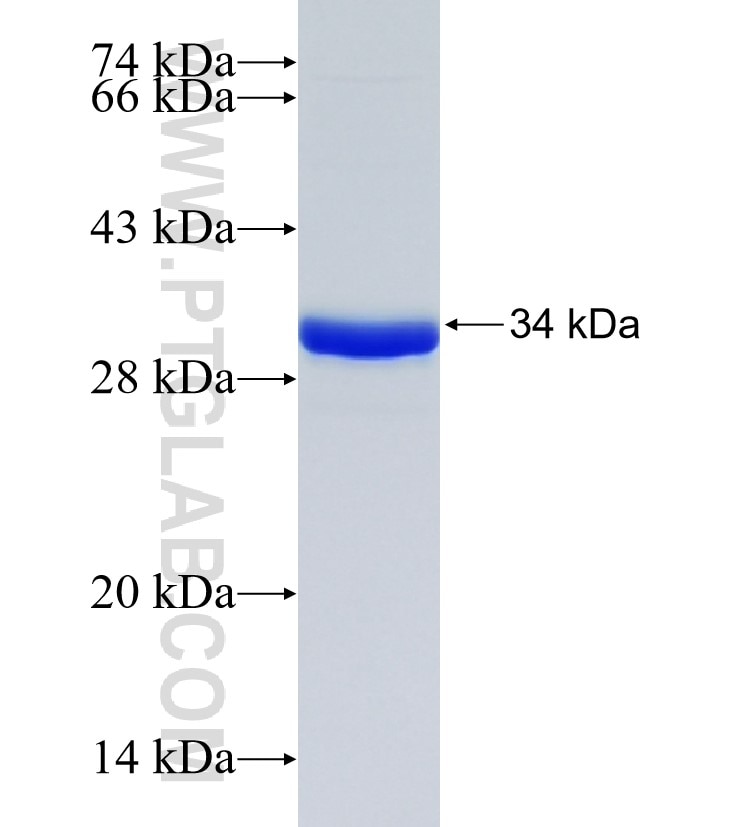 MARCH3 fusion protein Ag21635 SDS-PAGE MARCH3 fusion protein Ag21635 SDS-PAGE
