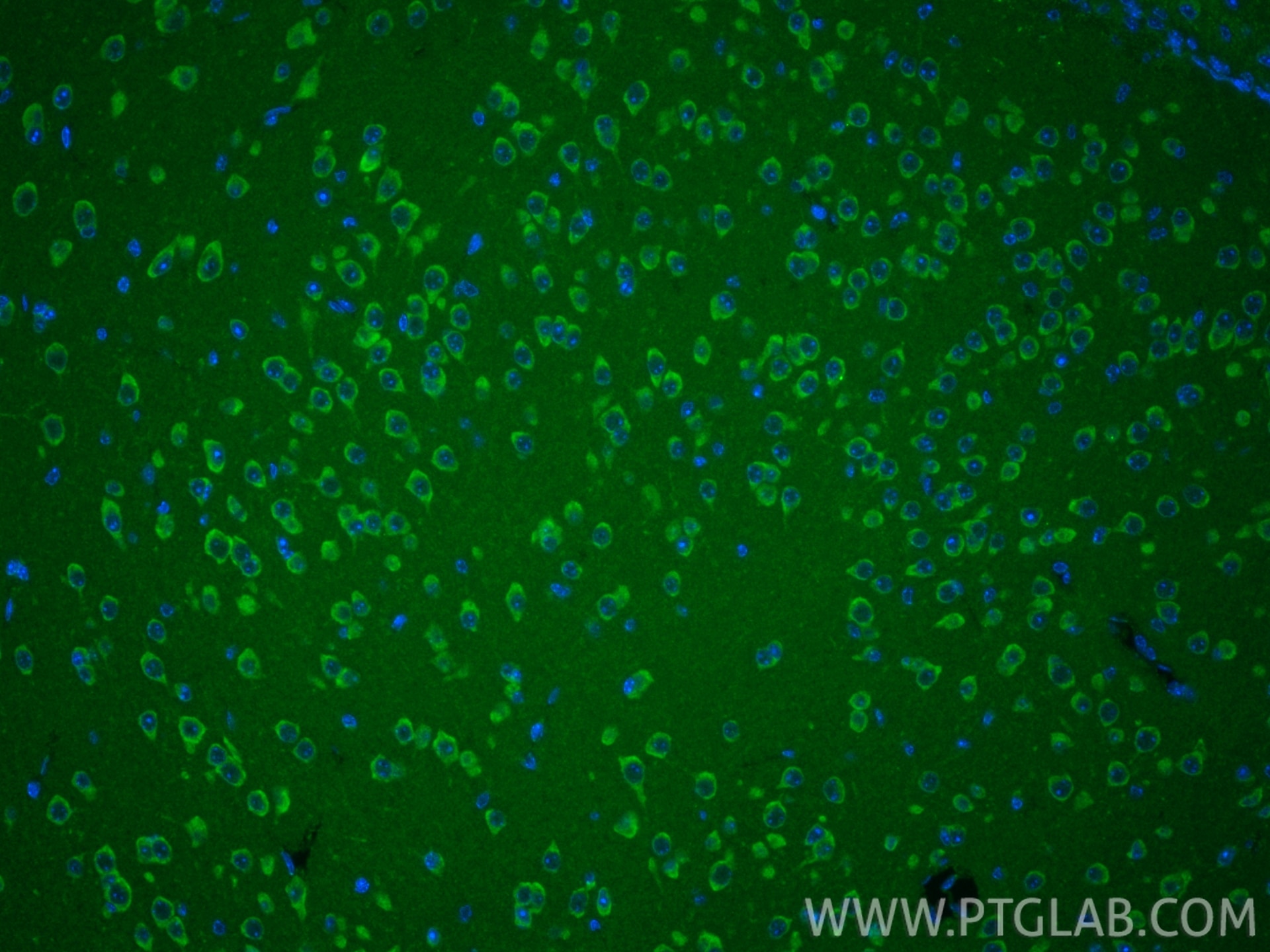 Immunofluorescence (IF) / fluorescent staining of mouse brain tissue using MARCH5 Polyclonal antibody (12213-1-AP)