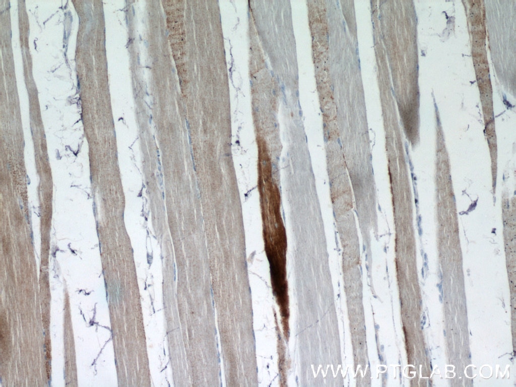 Immunohistochemistry (IHC) staining of human skeletal muscle tissue using MARCH5 Polyclonal antibody (12213-1-AP)