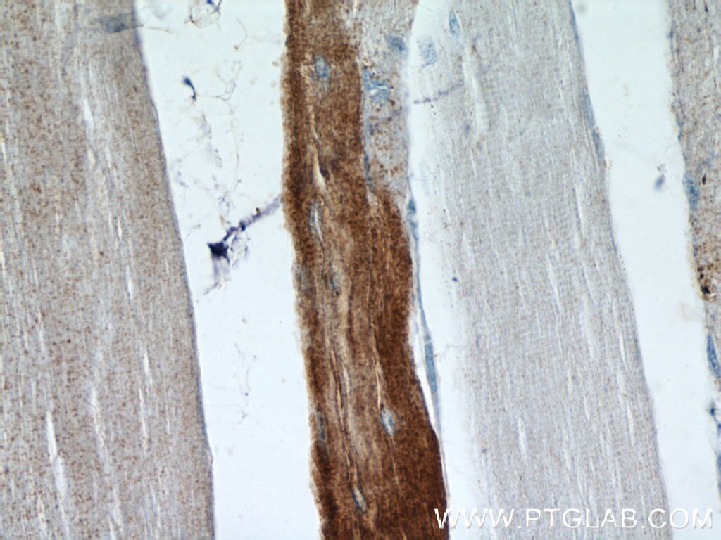 Immunohistochemistry (IHC) staining of human skeletal muscle tissue using MARCH5 Polyclonal antibody (12213-1-AP)