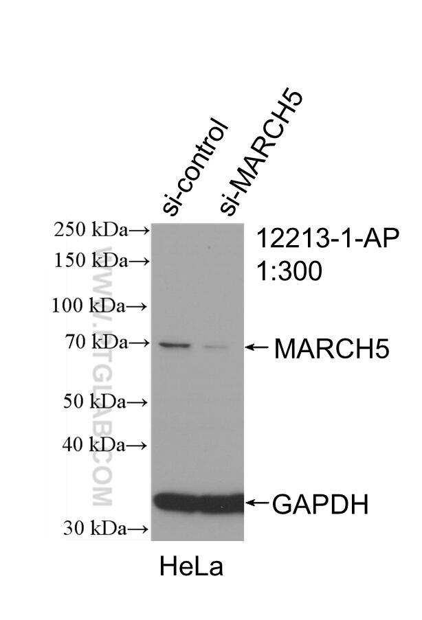 Western Blot (WB) analysis of HeLa cells using MARCH5 Polyclonal antibody (12213-1-AP)