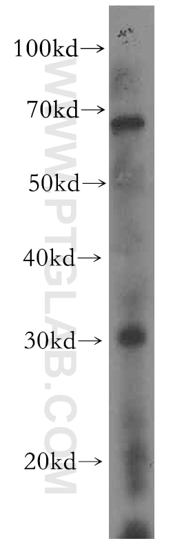 MARCH5 Polyclonal antibody
