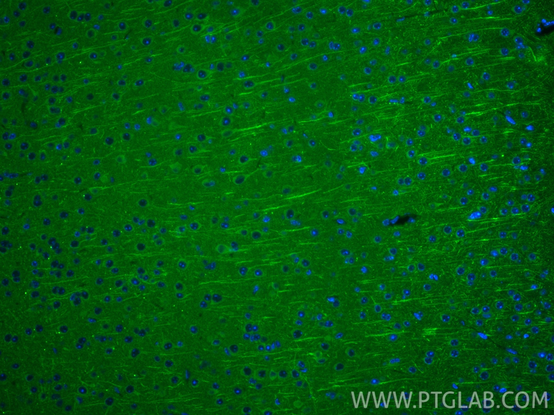 IF Staining of mouse brain using 87790-1-RR (same clone as 87790-1-PBS) Immunofluorescence (IF) / fluorescent staining of mouse brain tissue using MARCH5 Recombinant monoclonal antibody (87790-1-RR)