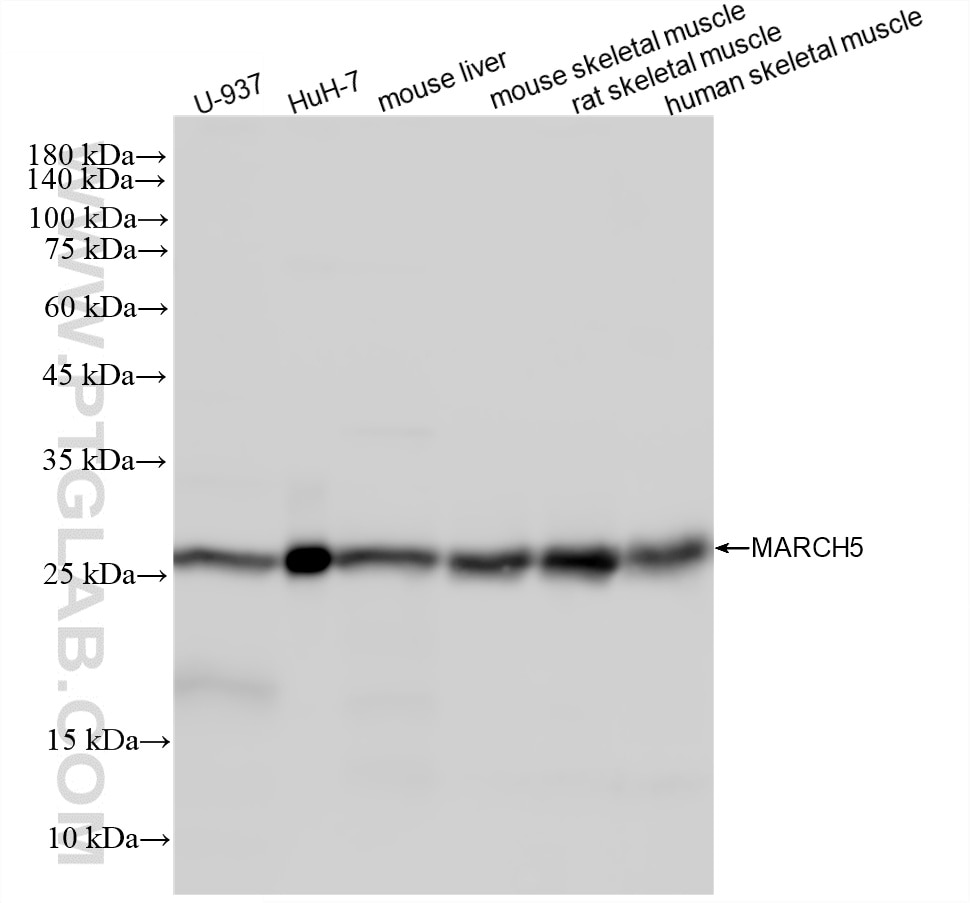 WB analysis using 87790-1-RR (same clone as 87790-1-PBS) Western Blot (WB) analysis of various lysates using MARCH5 Recombinant monoclonal antibody (87790-1-RR)