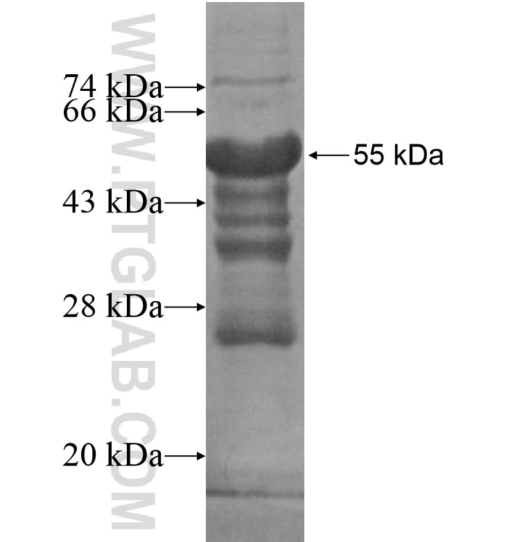 MARCH6 fusion protein Ag16183 SDS-PAGE
