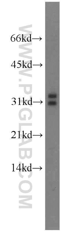 Western Blot (WB) analysis of mouse testis tissue using MARCH8 Polyclonal antibody (14119-1-AP)