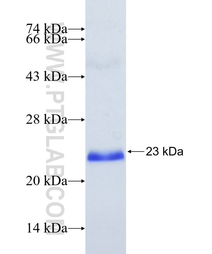 MARCH8 fusion protein Ag5379 SDS-PAGE