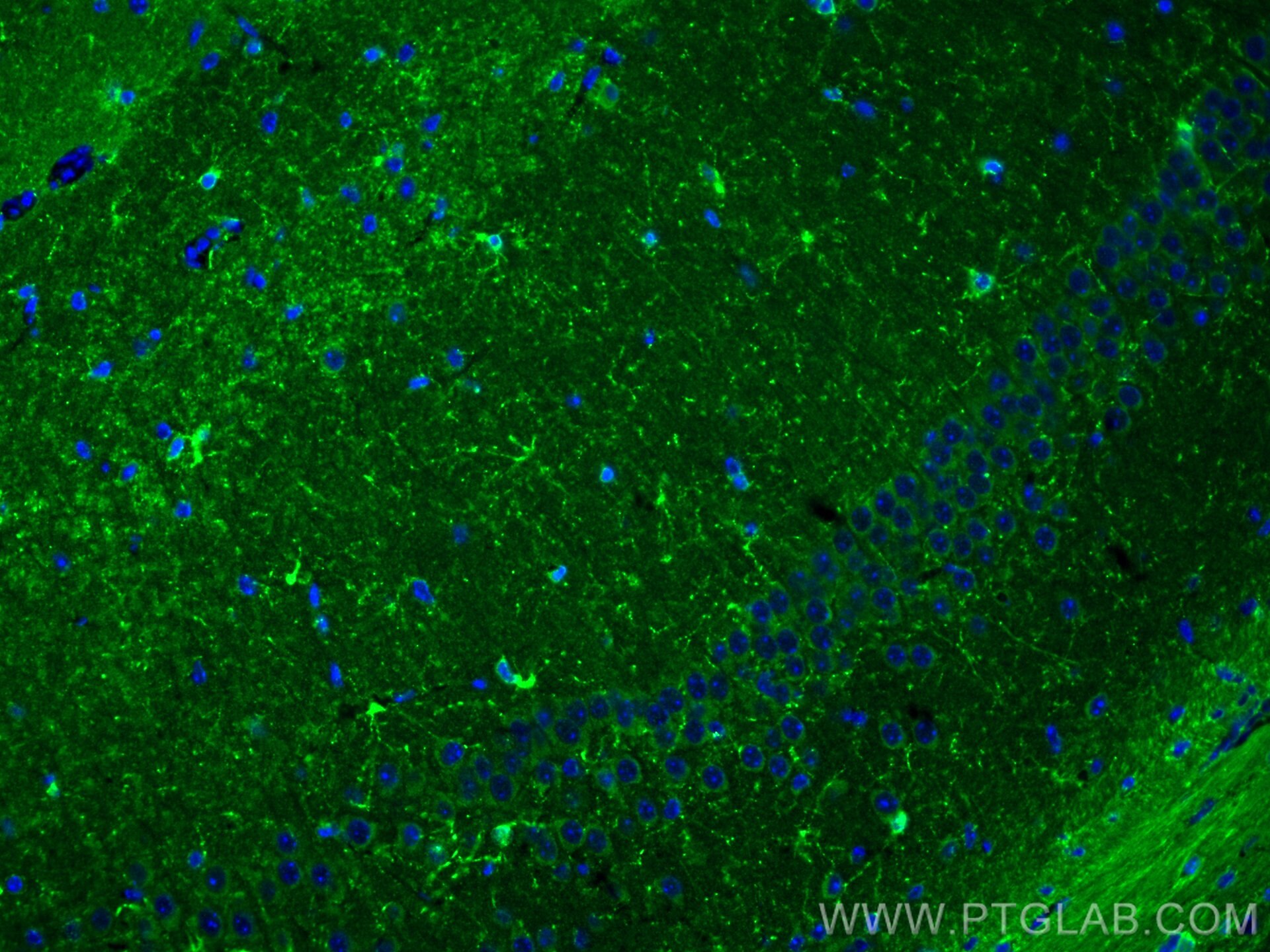 Immunofluorescence (IF) / fluorescent staining of mouse brain tissue using MARCKS Polyclonal antibody (20661-1-AP)
