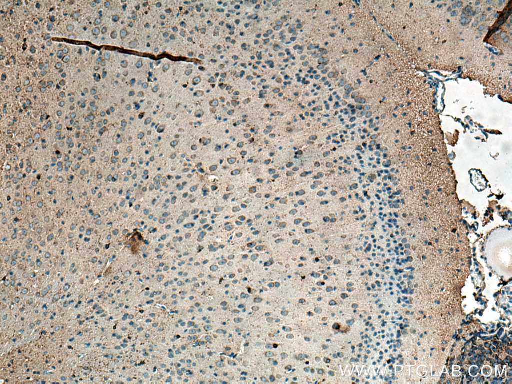 Immunohistochemistry (IHC) staining of mouse brain tissue using MARCKS Polyclonal antibody (20661-1-AP)