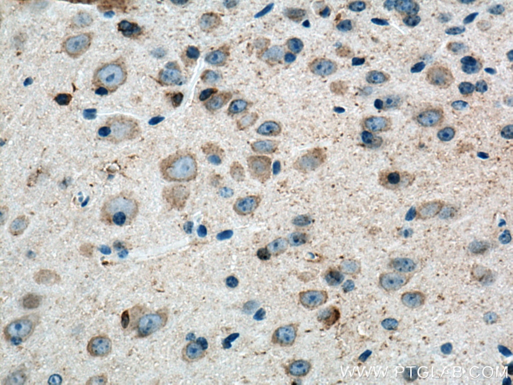 Immunohistochemistry (IHC) staining of mouse brain tissue using MARCKS Polyclonal antibody (20661-1-AP)