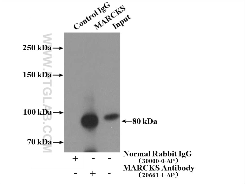 Immunoprecipitation (IP) experiment of A431 cells using MARCKS Polyclonal antibody (20661-1-AP)