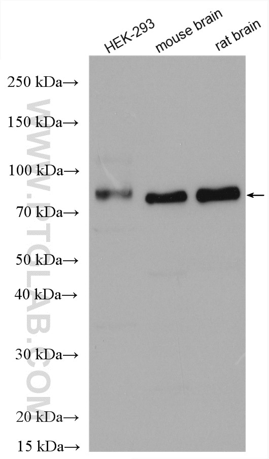 Western Blot (WB) analysis of various lysates using MARCKS Polyclonal antibody (20661-1-AP)