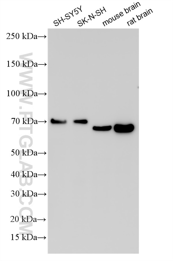 Western Blot (WB) analysis of various lysates using MARCKS Polyclonal antibody (20661-1-AP)