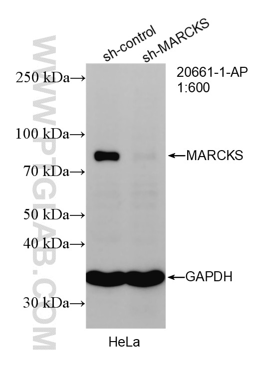 WB analysis of HeLa using 20661-1-AP Western Blot (WB) analysis of HeLa cells using MARCKS Polyclonal antibody (20661-1-AP)