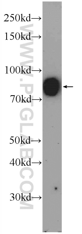 Western Blot (WB) analysis of mouse brain tissue using MARCKS Polyclonal antibody (51087-1-AP)