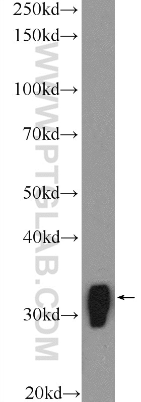 Western Blot (WB) analysis of mouse brain tissue using MARCKS Polyclonal antibody (51087-1-AP)