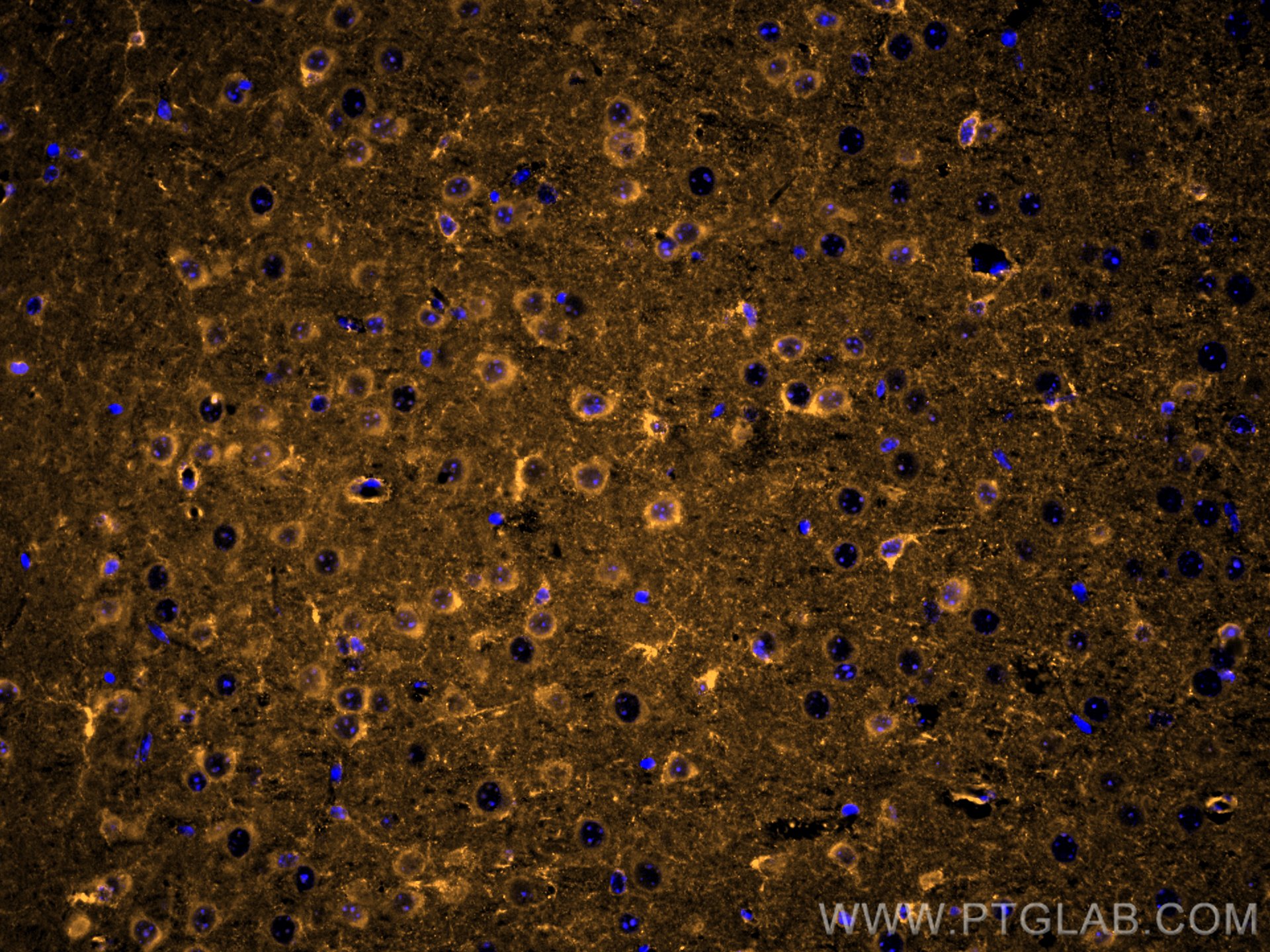 Immunofluorescence (IF) / fluorescent staining of mouse brain tissue using CoraLite®555-conjugated MARCKS Polyclonal antibody (CL555-20661)