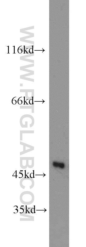 Western Blot (WB) analysis of human brain tissue using MARCKSL1 Polyclonal antibody (11422-1-AP)