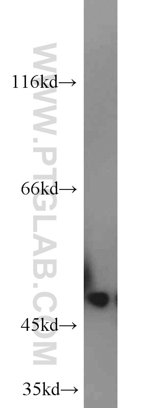 Western Blot (WB) analysis of human brain tissue using MARCKSL1 Polyclonal antibody (11422-1-AP)