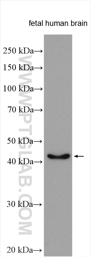 Western Blot (WB) analysis of various lysates using MARCKSL1 Polyclonal antibody (14124-1-AP)