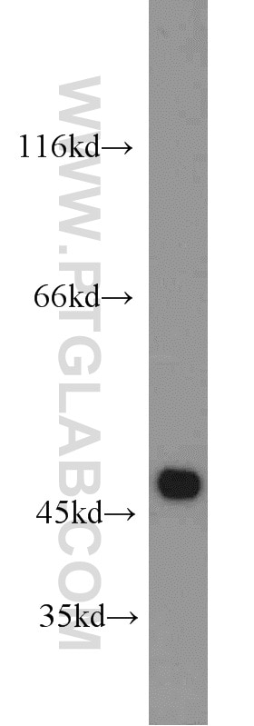 Western Blot (WB) analysis of human brain tissue using MARCKSL1 Polyclonal antibody (14124-1-AP)