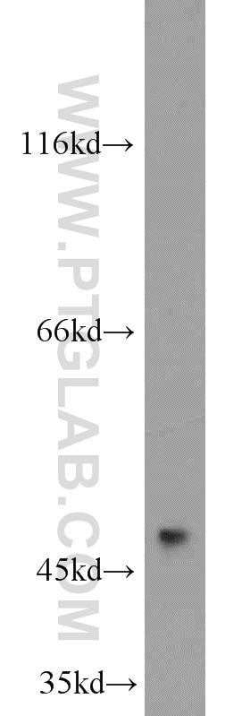 Western Blot (WB) analysis of human brain tissue using MARCKSL1 Polyclonal antibody (14124-1-AP)