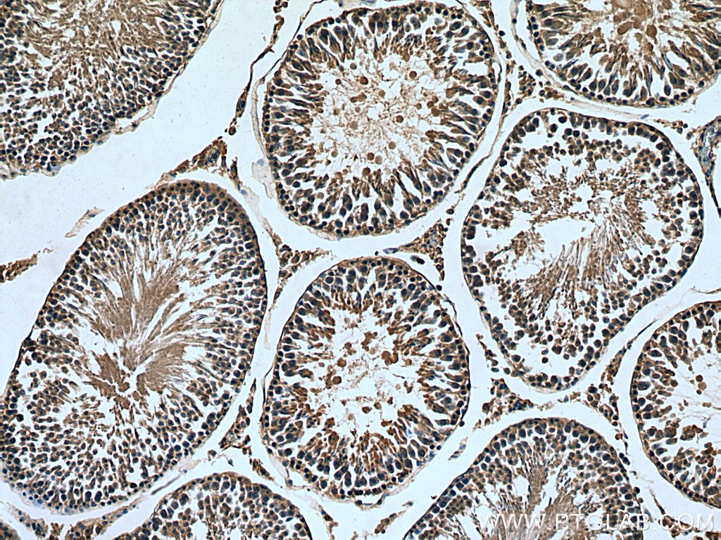 Immunohistochemistry (IHC) staining of rat testis tissue using MARK1 Polyclonal antibody (21552-1-AP)