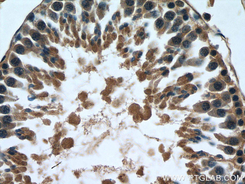 Immunohistochemistry (IHC) staining of rat testis tissue using MARK1 Polyclonal antibody (21552-1-AP)