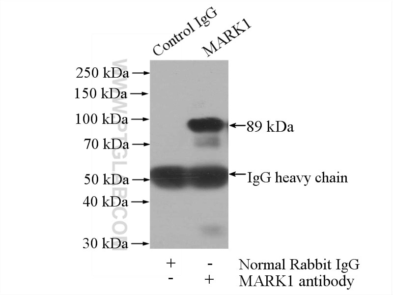 Immunoprecipitation (IP) experiment of mouse brain tissue using MARK1 Polyclonal antibody (21552-1-AP)