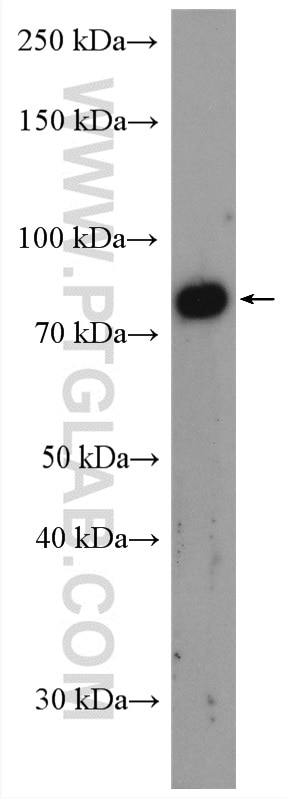 Western Blot (WB) analysis of HeLa cells using MARK1 Polyclonal antibody (21552-1-AP)