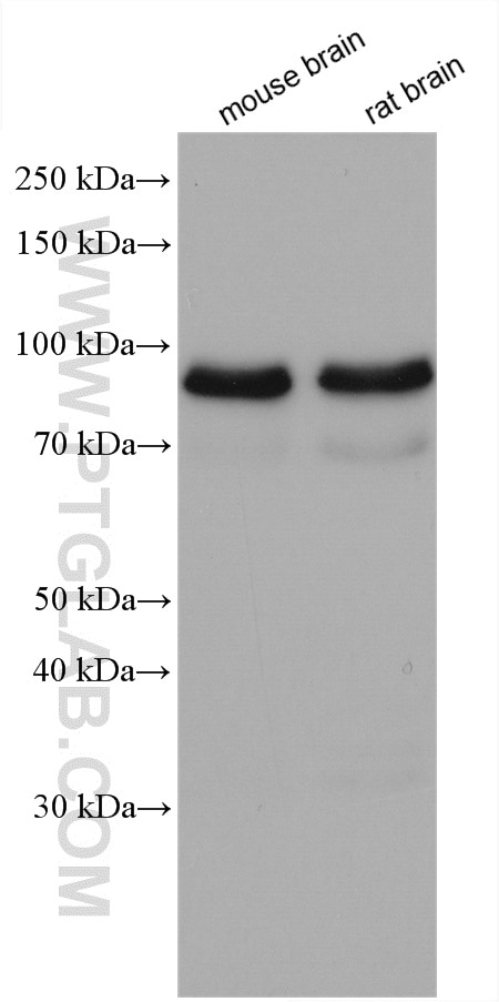 Western Blot (WB) analysis of various lysates using MARK1 Polyclonal antibody (21552-1-AP)