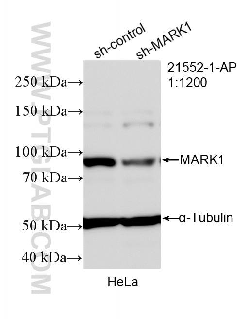 Western Blot (WB) analysis of HeLa cells using MARK1 Polyclonal antibody (21552-1-AP)